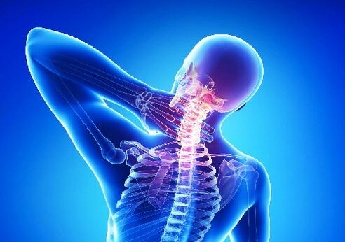 osteocondrose cervical